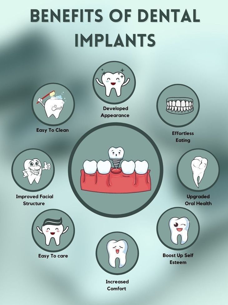 Dental Implants in Kukatpally