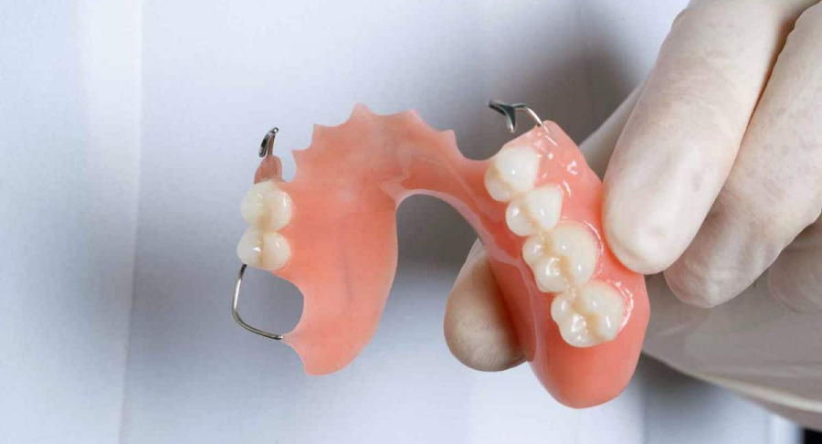 Denture Treatments In Kukatpally
