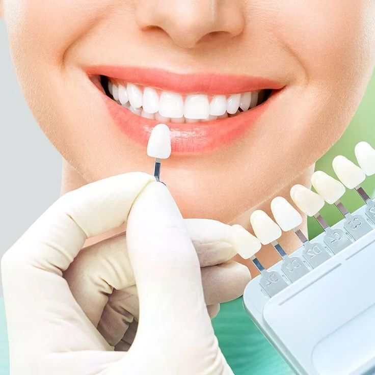 Smile Makeover Treatment in Kukatpally dental care
