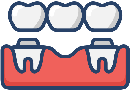 Bridge and crowns