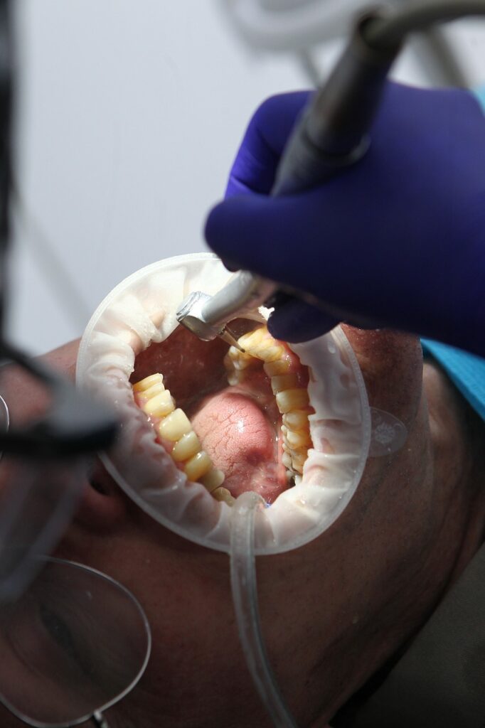 dentist, oral health, dental health, oral hygiene, dental hygiene, teeth, teeth cleaning, teeth whitening, dentist, dentist, dentist, dentist, dentist, oral health, dental health, teeth, teeth, teeth cleaning, teeth cleaning, teeth whitening, teeth whitening, teeth whitening