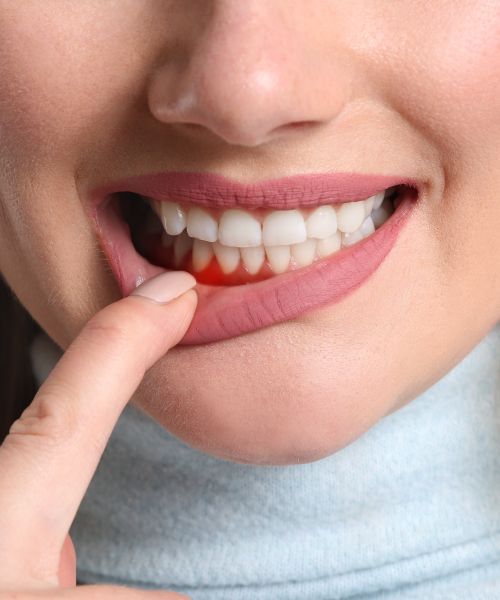 Best Gum Specialist in Kukatpally