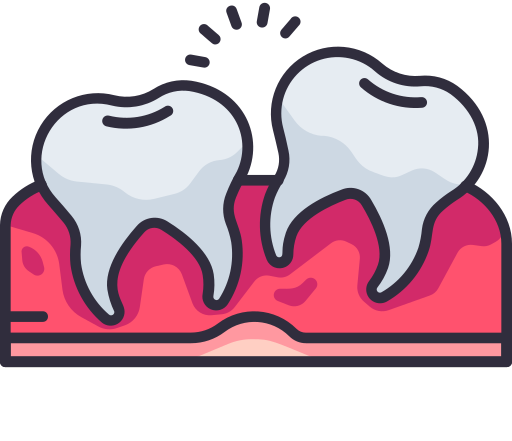 Wisdom tooth