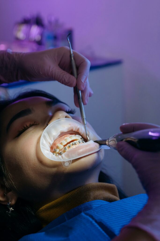 Best Dental Bridges And Crowns Treatment In Kukatpally