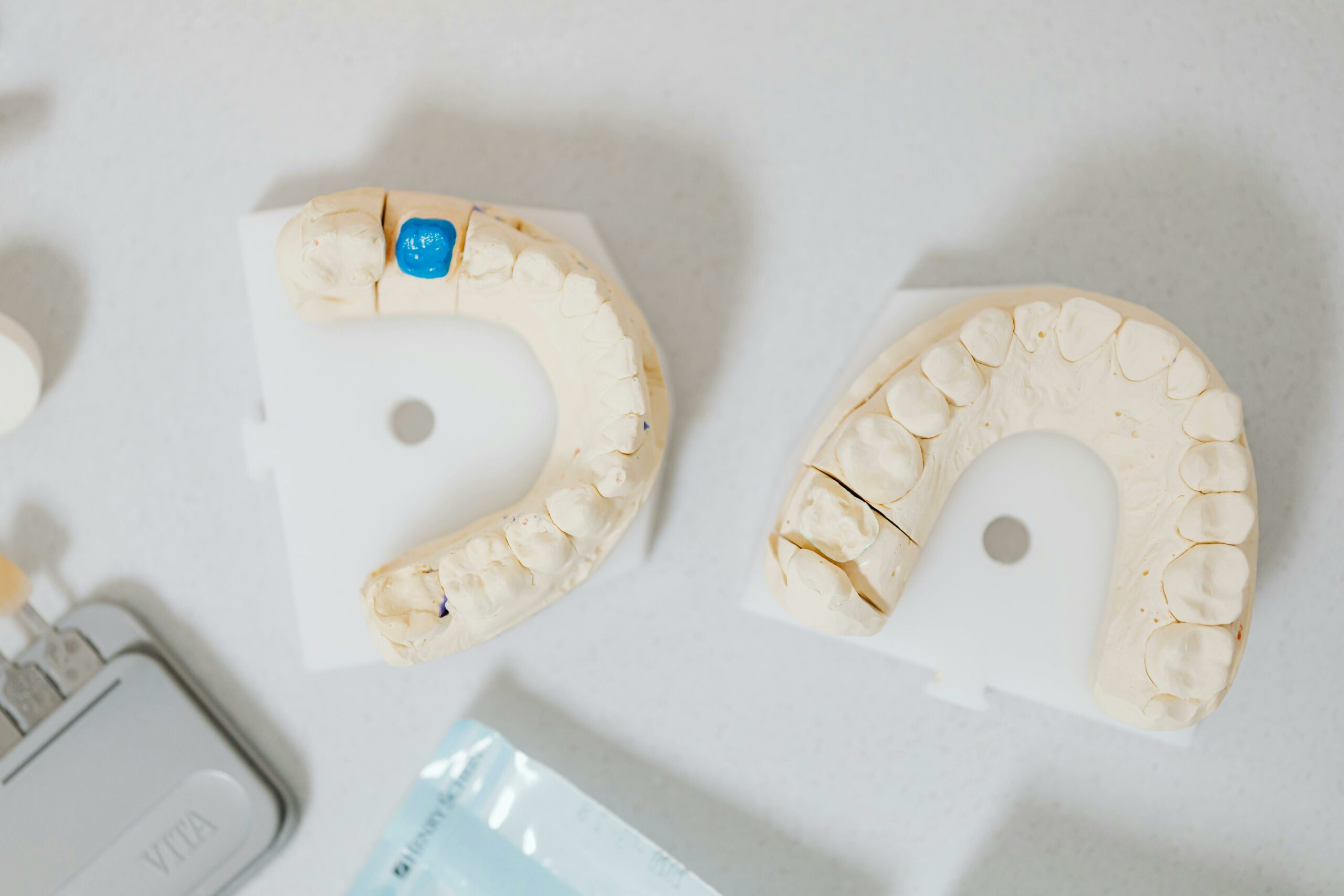 Close-up of dental molds on a white table, showcasing orthodontic details.