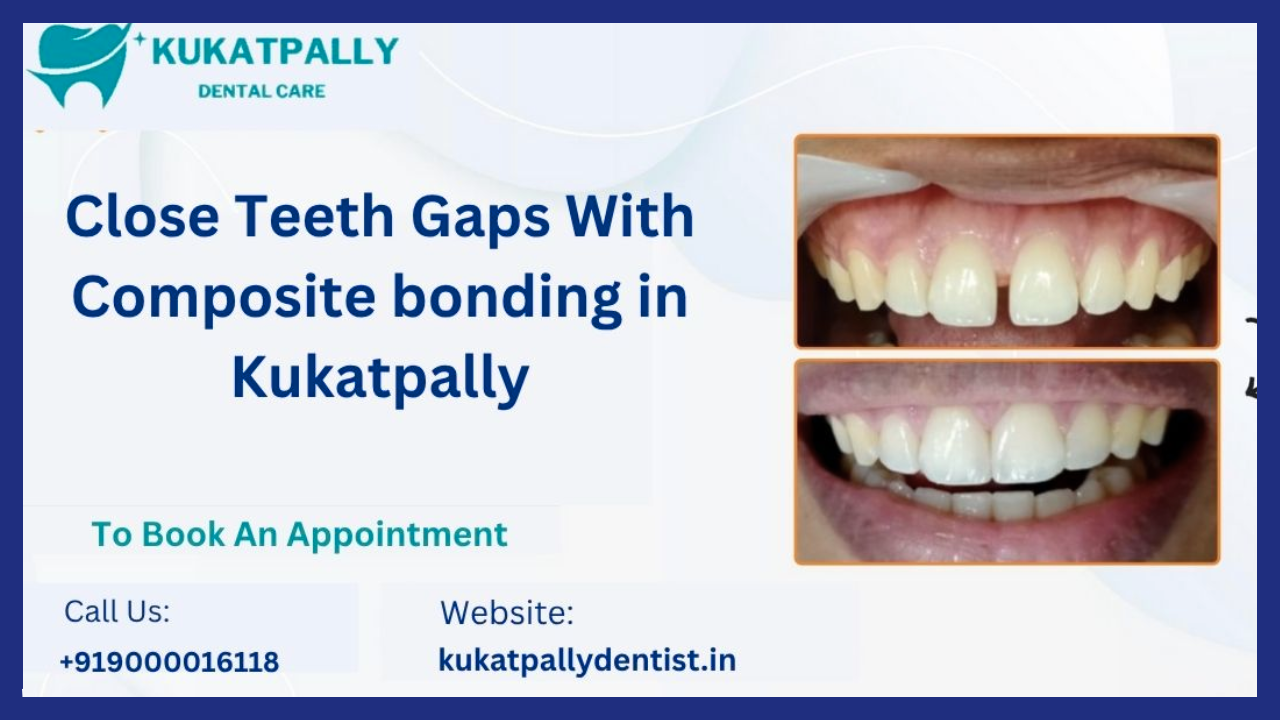Close Teeth Gaps with Composite Bonding Treatment in Kukatpally