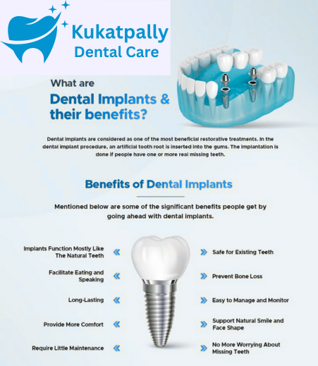 Best Tooth Replacement methods