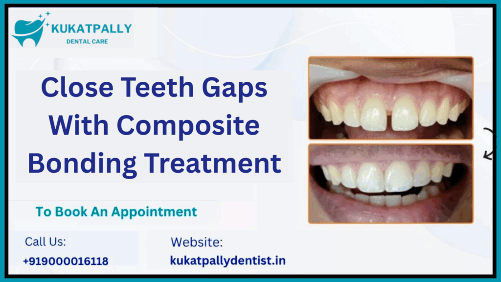 Close Teeth Gaps with Composite Bonding Treatment